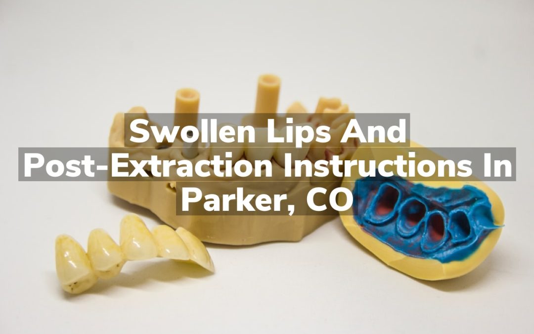 Swollen Lips and Post-Extraction Instructions in Parker, CO